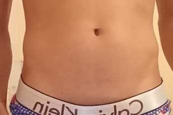 Pirocudo